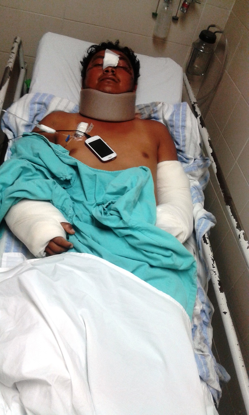 Sufre atentado reportero de policiaca  del diario El Imparcial