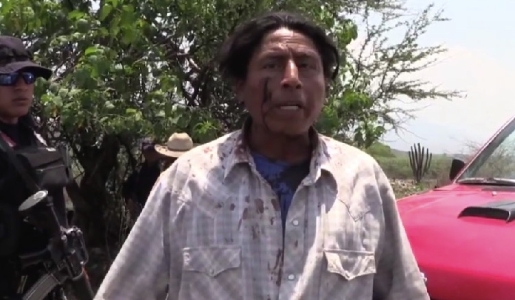 Domingo de enfrentamiento en Ocotlán: 3 heridos, uno grave; 1 auto incendiado