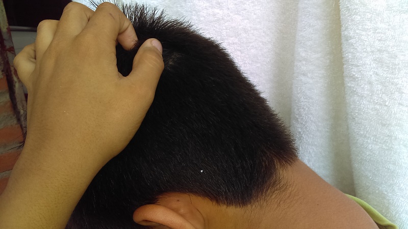 La higiene, aliado para evitar los piojos