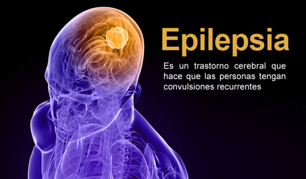 Fundamental para su control, valoración inmediata de jóvenes con epilepsia: neurocirujano del IMSS