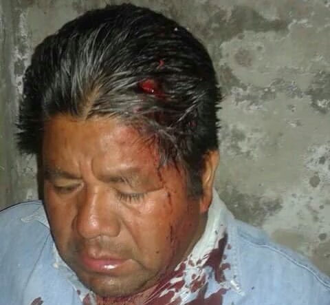 Muere maestro herido en desalojo del IEEPO; suman 9 los muertos en operativos policiales