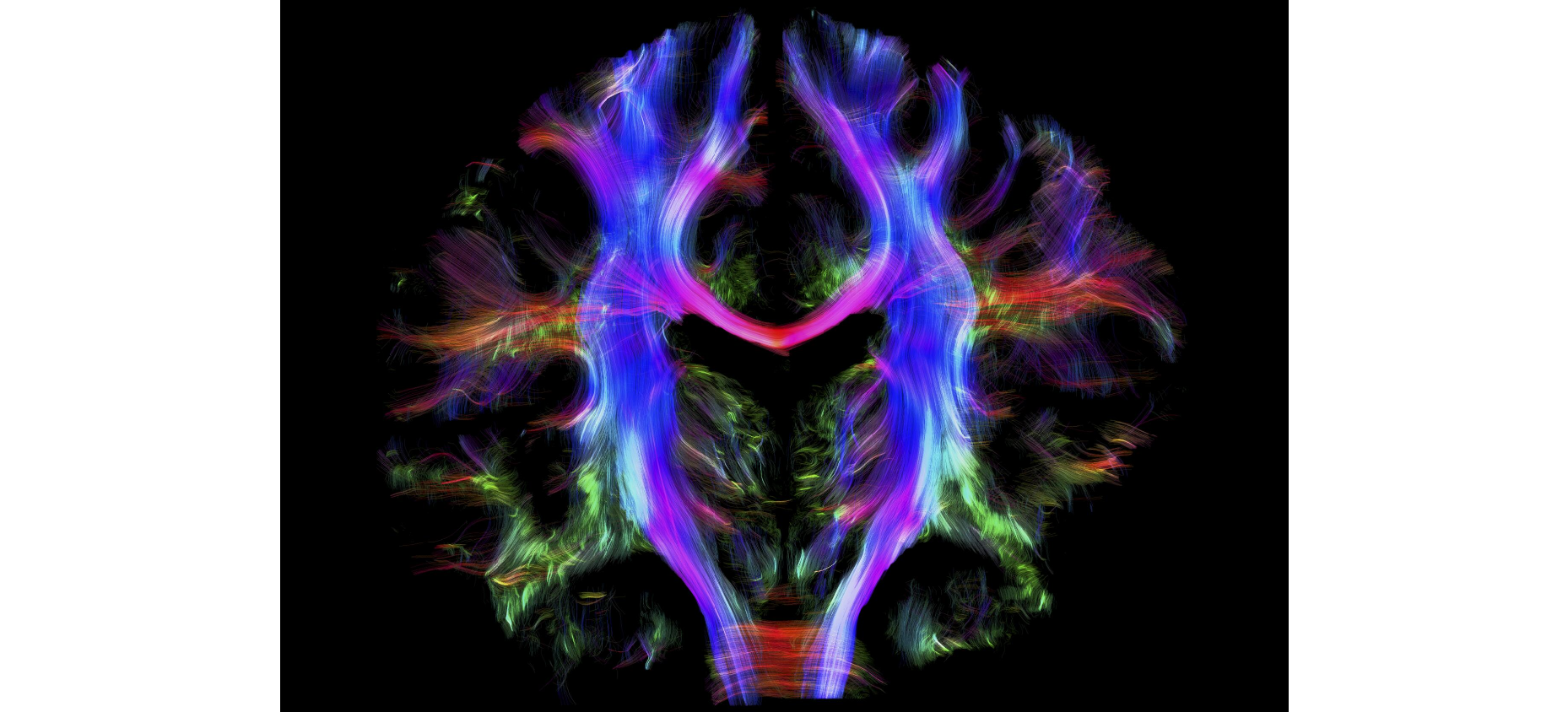 #Imagendeldía Fibras nerviosas en el cerebro sano de un adulto joven