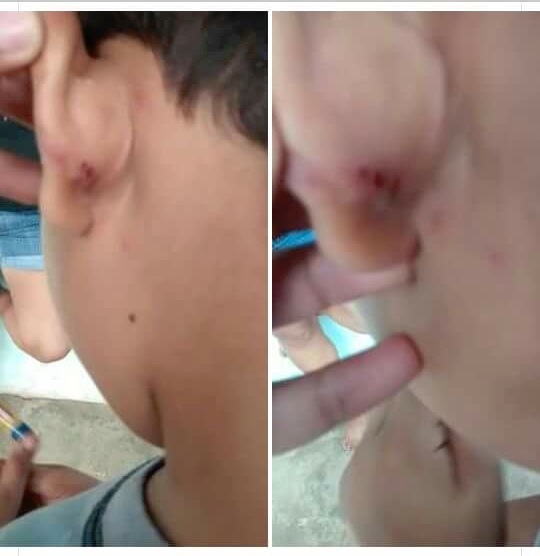foto-de-la-herida-de-la-presunta-agresion-al-menor