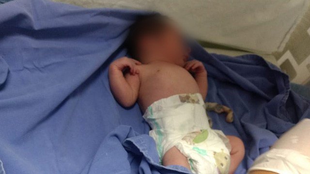Tercer alta de recién nacido afectado por brote infeccioso en el Hospital General Regional 72 de Tlalnepantla