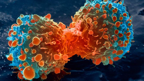 La quimioterapia mata incluso células sanas, el cannabis solo las cancerosas