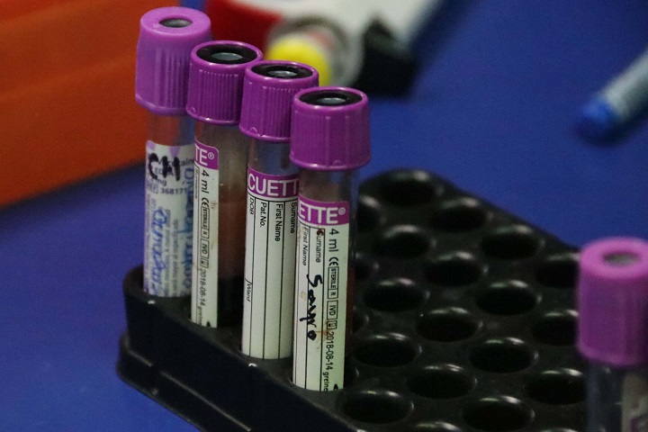 Una persona que dona sangre puede salvar hasta tres vidas: investigador UABJO