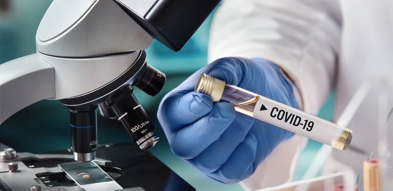 ¿Estuvimos equivocados todo este tiempo? COVID-19 es una enfermedad vascular, revela estudio