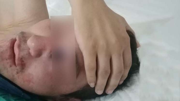 Se registran dos casos sospechosos de hongo negro en Oaxaca: SSO