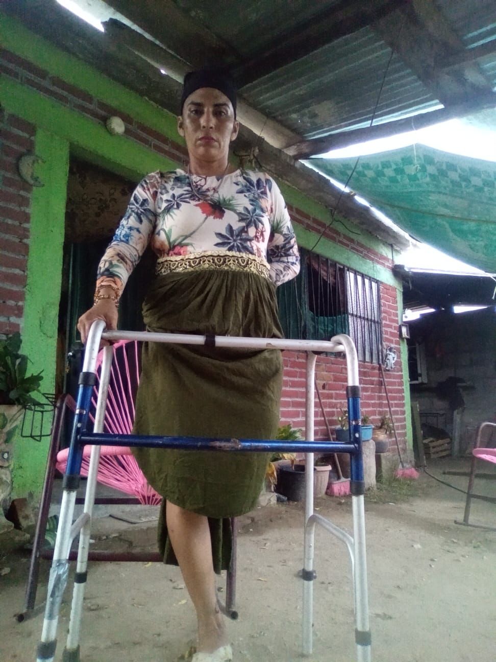 Artesana zapoteca exige justicia: Sufrió accidente, perdió la pierna y la declaran culpable