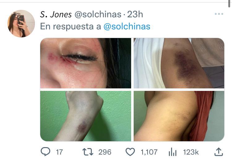 Sobreviviente de feminicidio acusa a jueza de entorpecer su proceso de obtener justicia