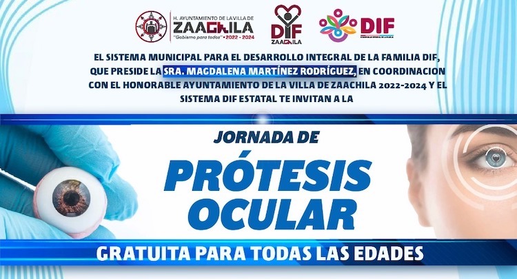 Prótesis de ojo gratuitas en Zaachila; ve los requisitos