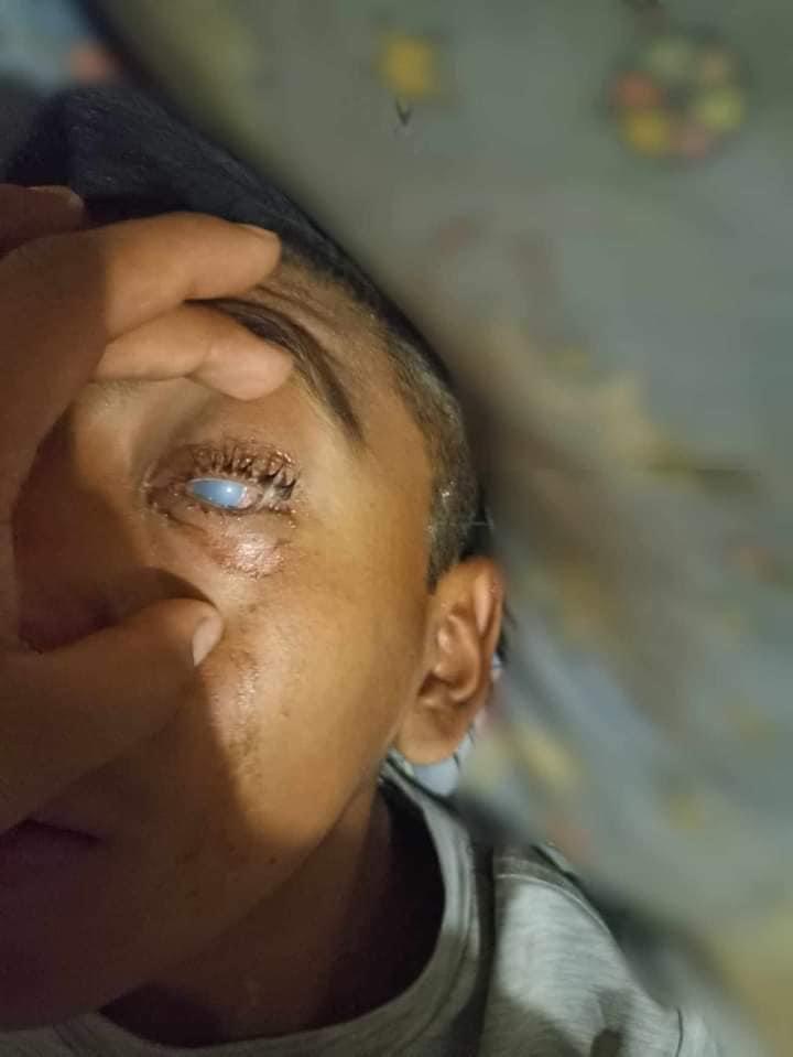 Investiga Fiscalía de Oaxaca caso de bullying que provocó lesiones en ojo de un estudiante